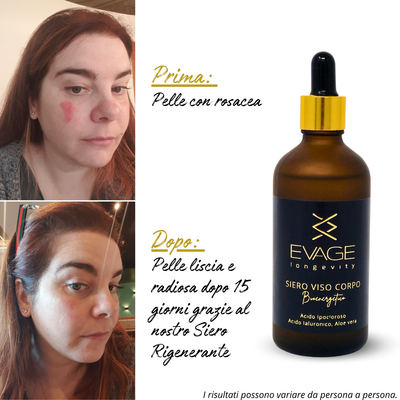 Siero antiage viso con Acido Ipocloroso e Aloe Vera per pelle luminosa